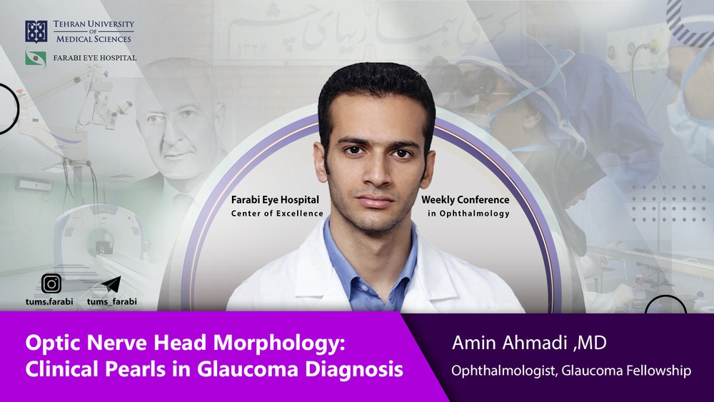 ارزیابی سر عصب بینایی در گلوکوم؛ نکات بالینی کلیدی برای تشخیص دقیق